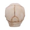 Eyes Wide Open (Pink) Decorative Resin Skull – billede 6